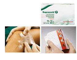 MEDICAZIONE STERILE IN FILM IN POLIURETANO TRASP. SUPRASORB F 5X7CM 10 PEZZI - Farmacia Artemisia di Montecuollo Dott. Angelo snc